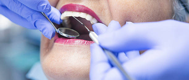 Best Emergency Treatment for Dental Infections or Abscesses in Hurst, TX